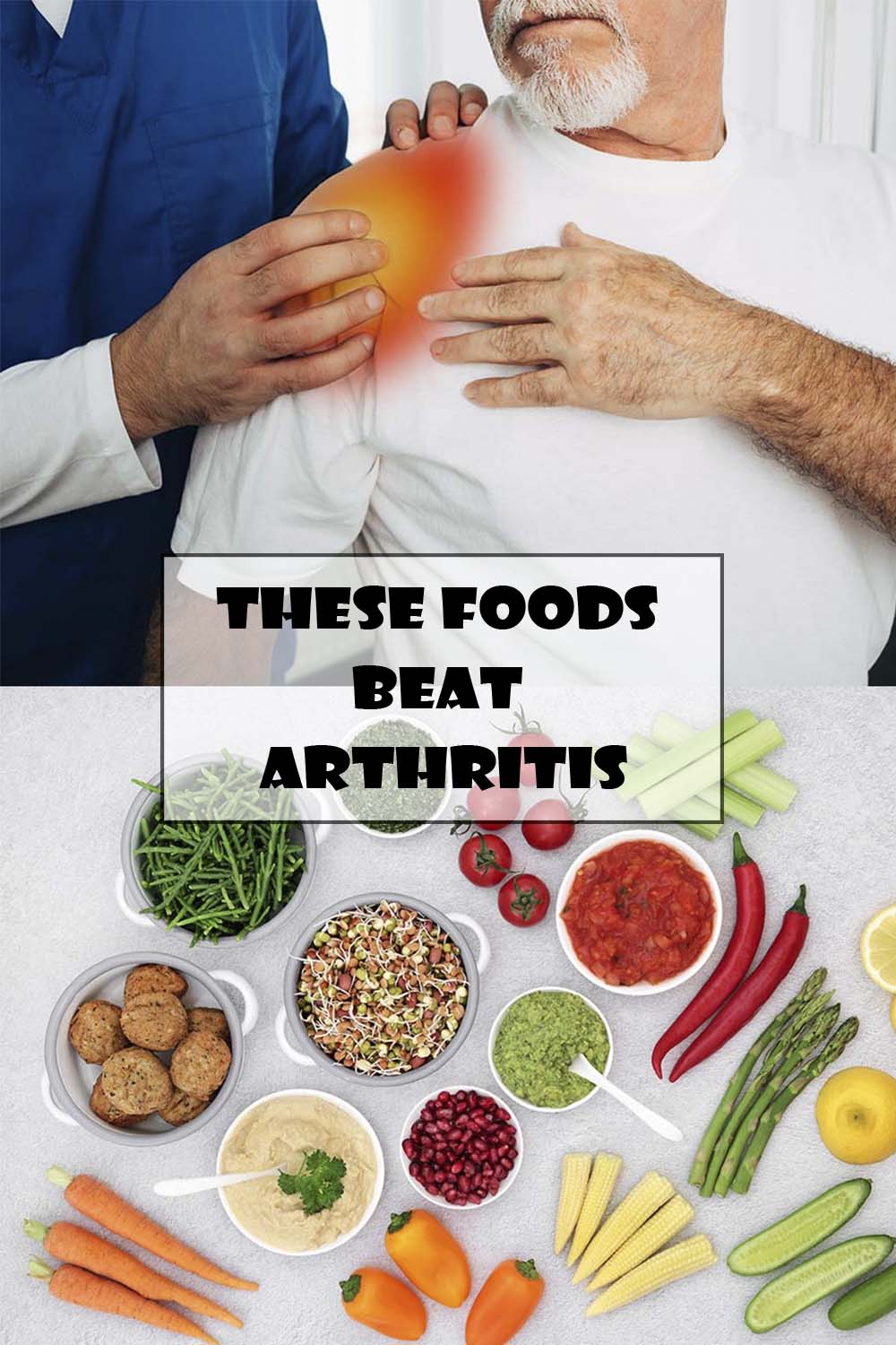 The Arthritis Step by Step Strategy